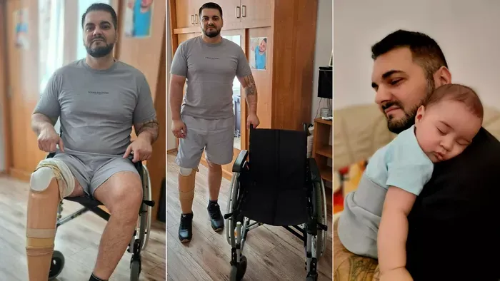 Buerger-kór miatt kellett amputálni a fiatal édesapa lábát