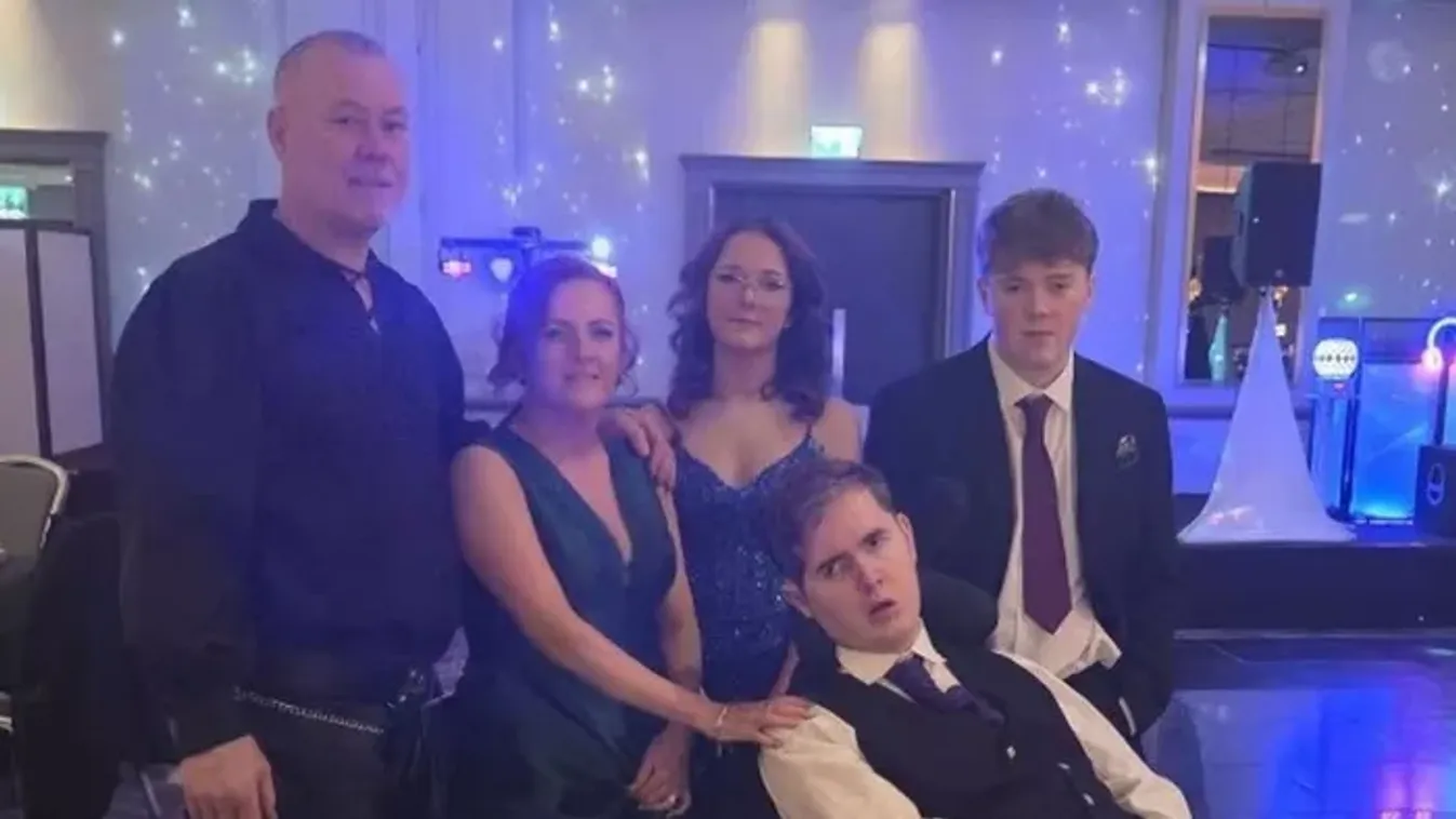 Biciklibaleset változtatta meg az életét: 100 km/órával haladó autó ütötte el, koponyájának háromnegyedét eltávolították a tinédzsernek