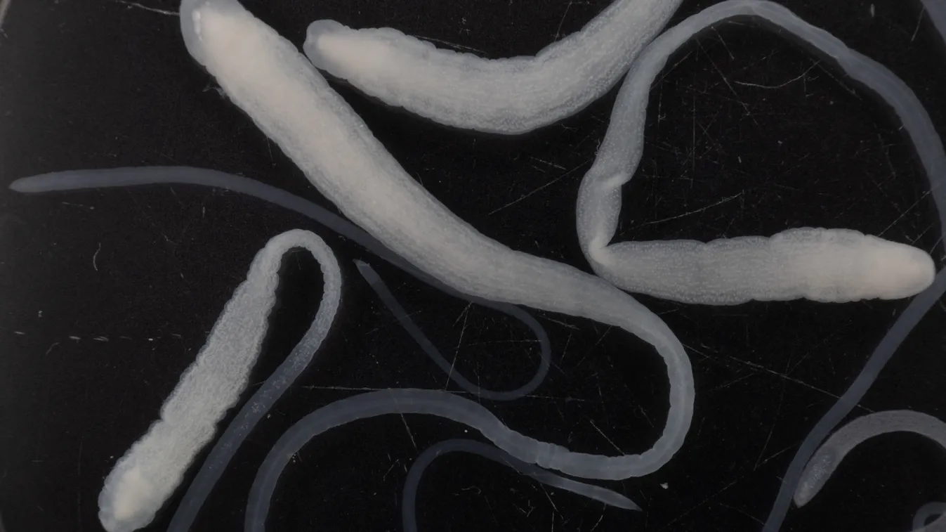 9 méteres szörnyeteg is lakhat a hasadban: ez a galandférgesség 5 leggyakoribb figyelmeztető jele