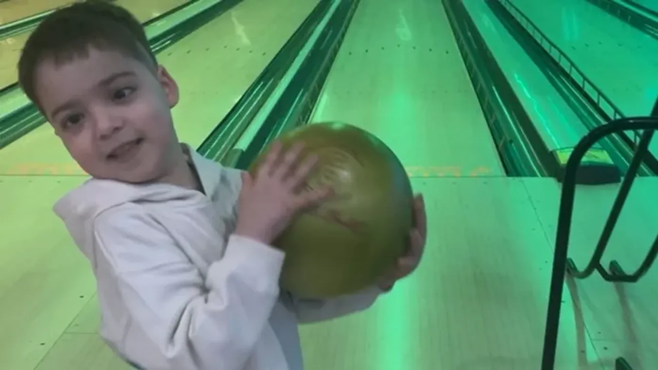 Még az orvosokat is sokkolta: Golflabda-méretű lett a kisfiú szeme