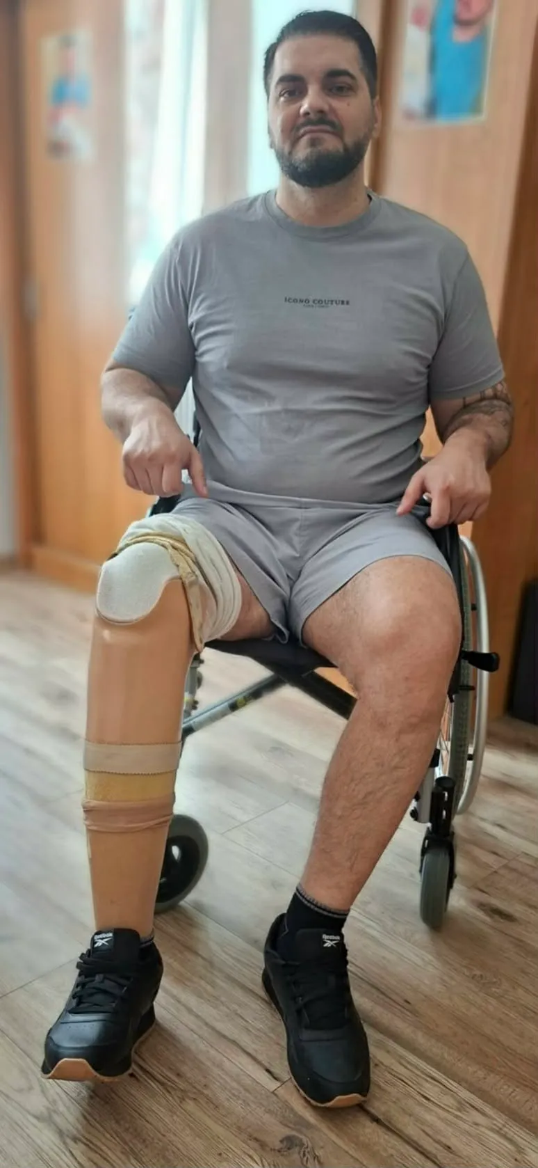 Buerger-kór támadta meg Tamást, amputálni kellett az egyik lábát