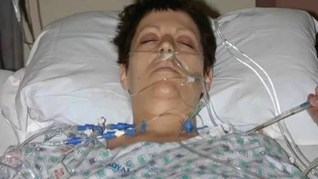 Nem hitte volna, hogy ez történik: édesapja kabátja miatt lett rákos az anyuka