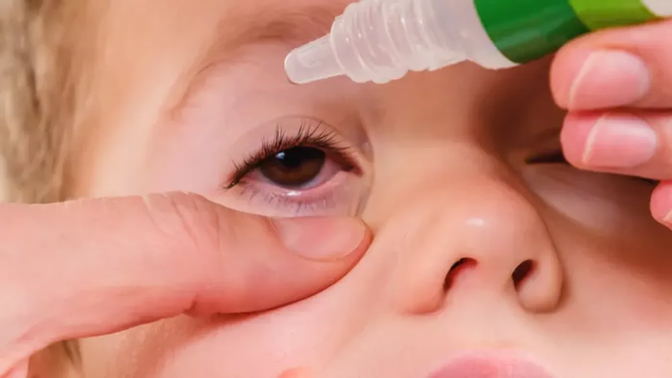 Kötőhártya-gyulladás a gyereknél: nem mindegy, mi okozza