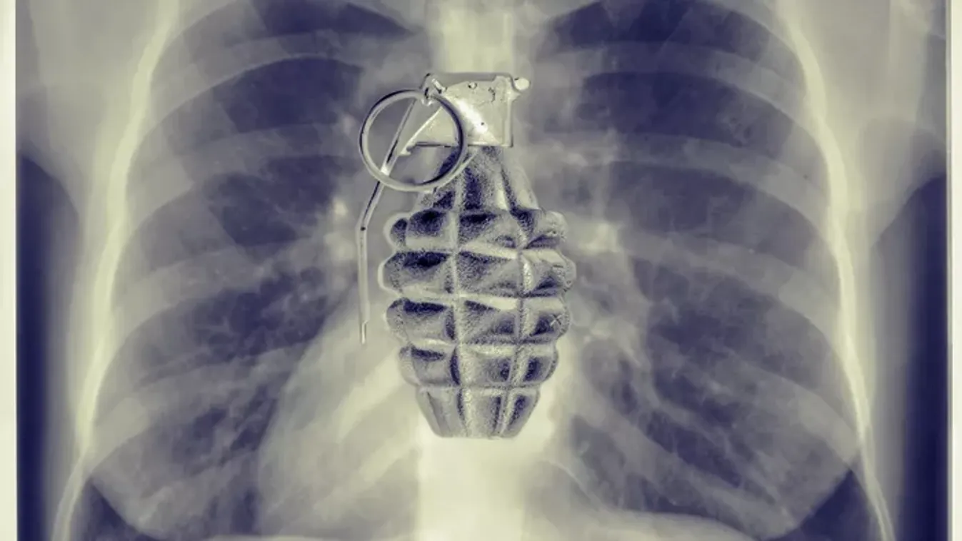 Időzített bomba ketyeg a testedben: csak a kardiológia „Szent Grálja” hatástalaníthatja időben