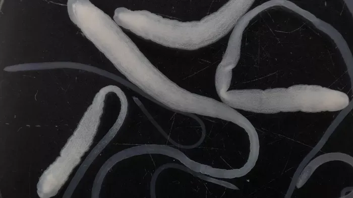 Ezek a leggyakoribb galandféreg-fertőzés jelek