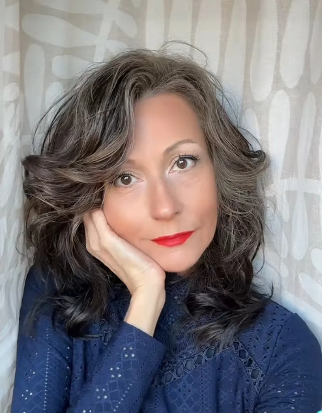 Az arcdaganata hatalmasra nőtt, de már alig látszik 