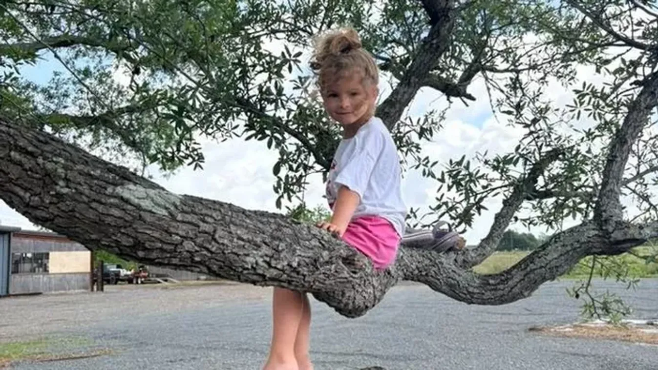 Genetikai rendellenességgel küzd a 6 éves kislány, fémrudakkal hosszabbítják meg a gyermek lábait