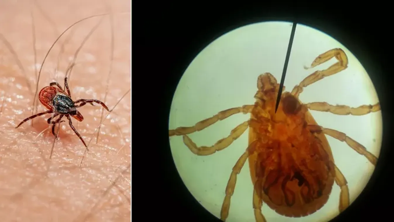 Nyolc láb, csíkos minta és halálos kór: itt az új magyar szuperkullancs!