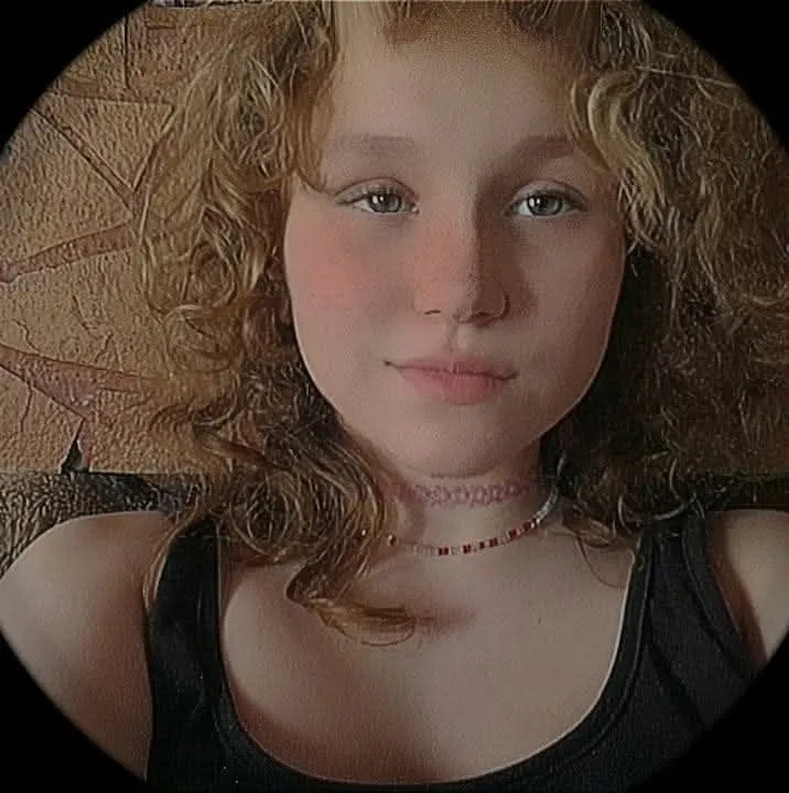 Eliza nehezen fogadta el, hogy kihullott a haja, most parókát szeretne 