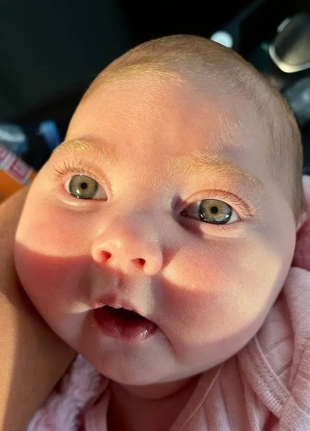 Mikrokefália: fejletlen agy szindrómája volt a babának