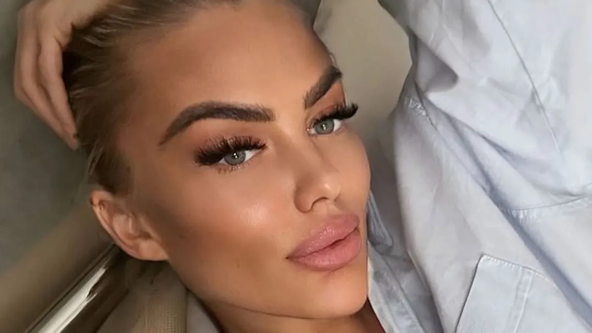 Kés alá feküdt Géczi Bea, sokkoló műtétjéről vallott: „Már zavart, hogy ilyen nagy...”