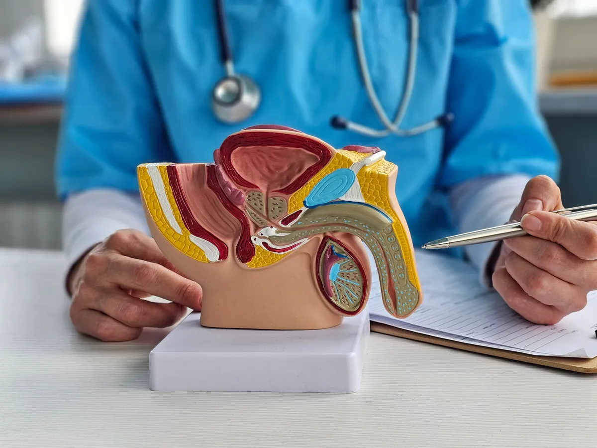 péniszrák jeleit mutatja egy orvos a maketten