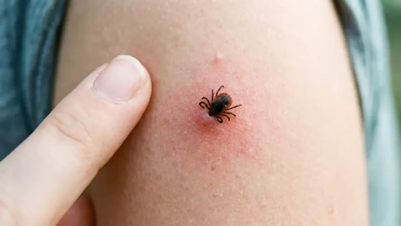 7 súlyos kullancs által terjesztett betegség, amiről sokan nem is tudnak