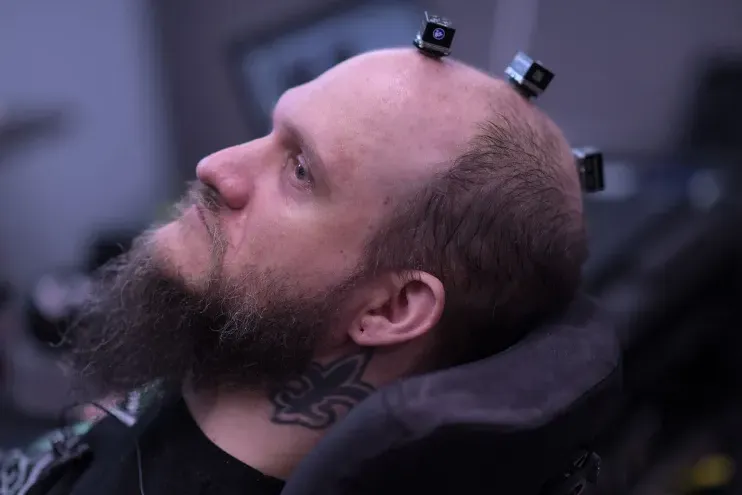 A férfi lett az első akinek agy-számítógépet ültettek a fejébe.