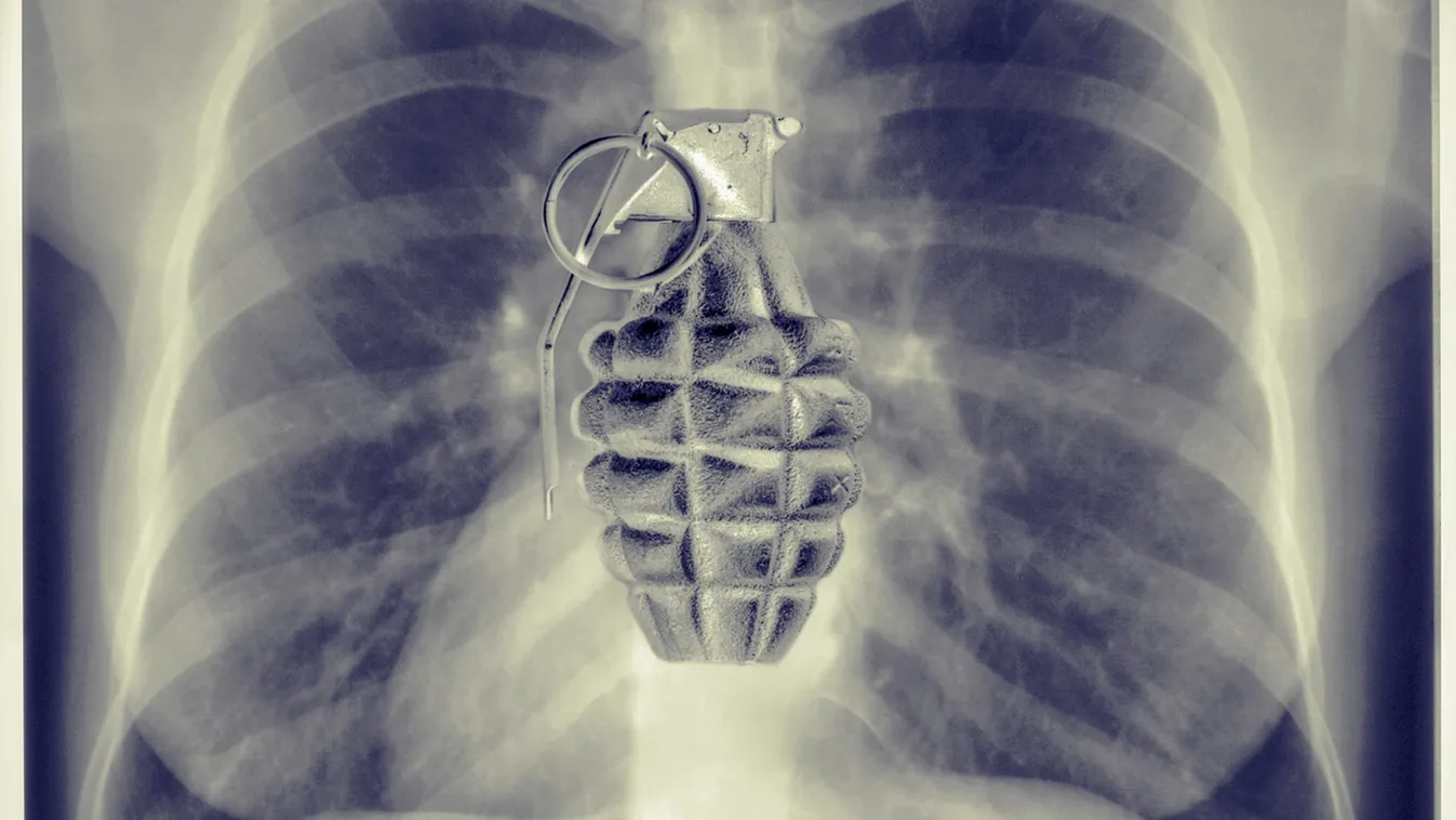 Időzített bomba ketyeg a testedben: csak a kardiológia „Szent Grálja” hatástalaníthatja időben