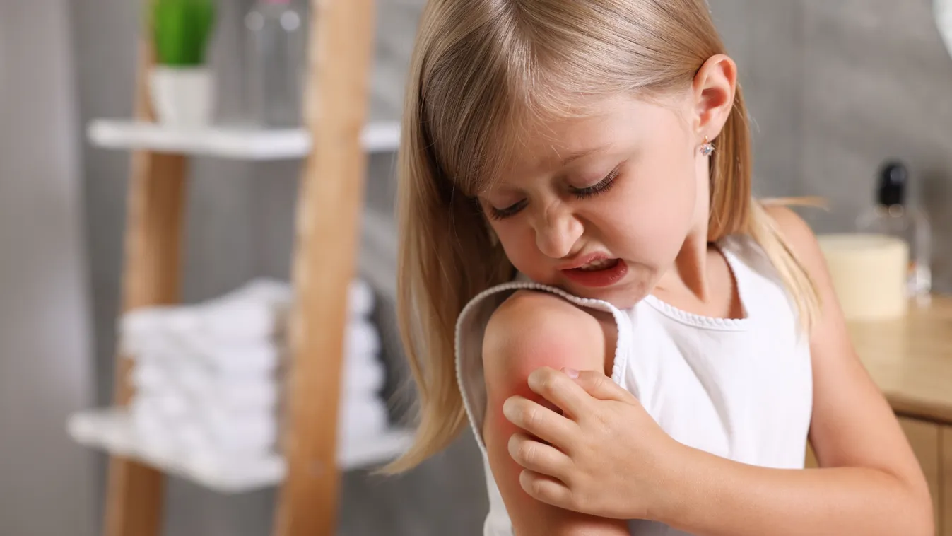 Ekcéma lelki okai egy kislánynál, aki vakarja magát.