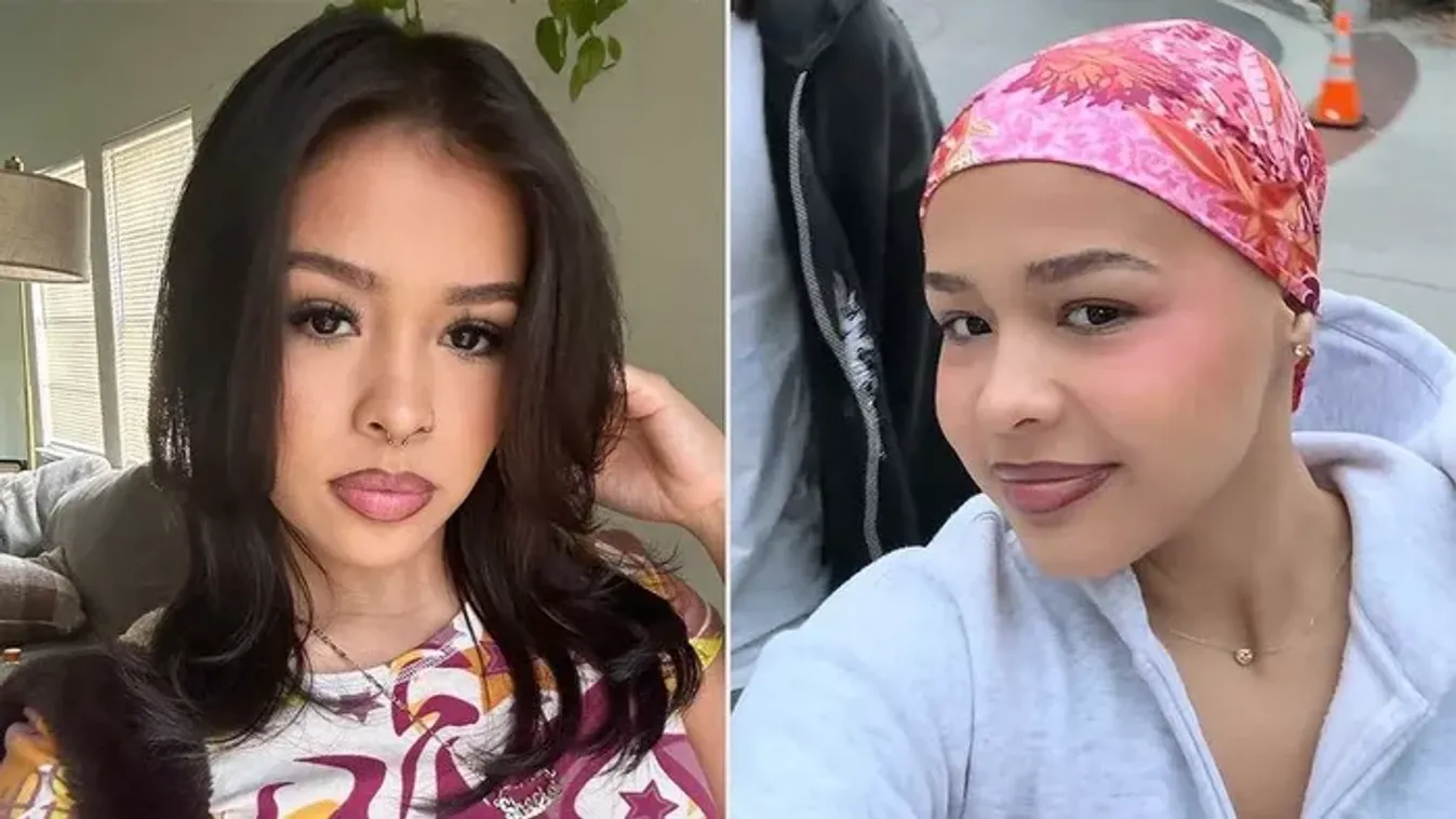 Borzasztó fájdalmak kínozták a fiatal lányt: az orvosok is ledöbbentek a végső diagnózison