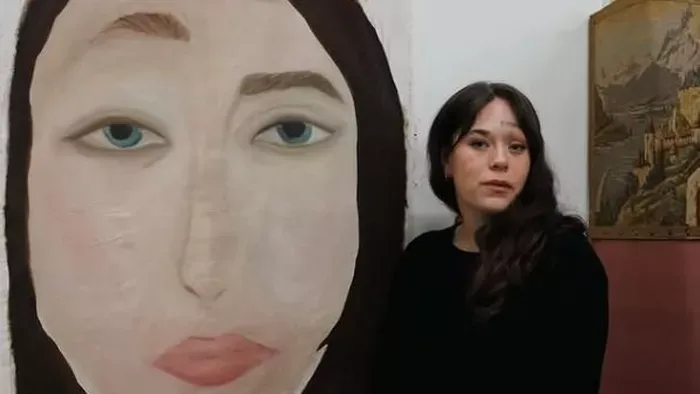 Ritka bőrbetegsége miatt „két arccal” született