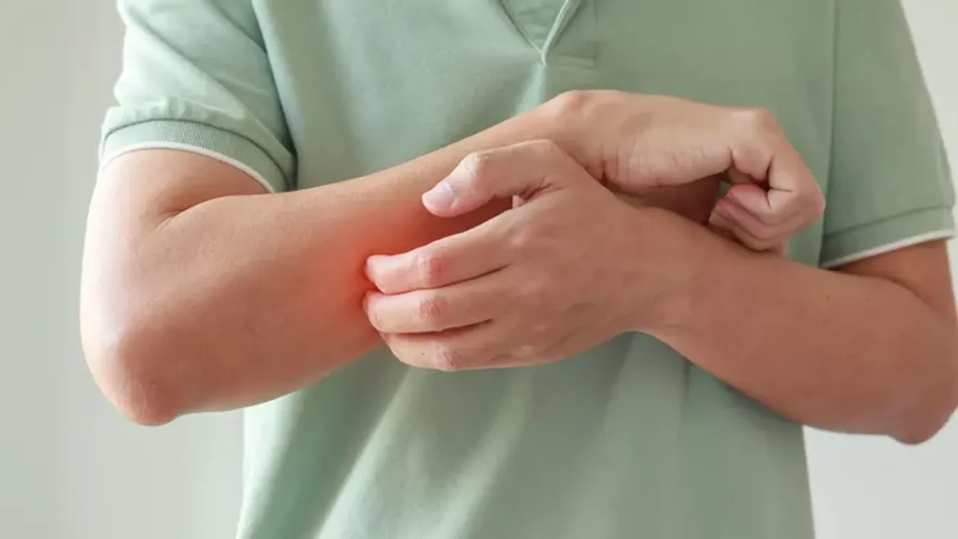 Bőrviszketéstől szenvedsz? Súlyos betegség jele lehet