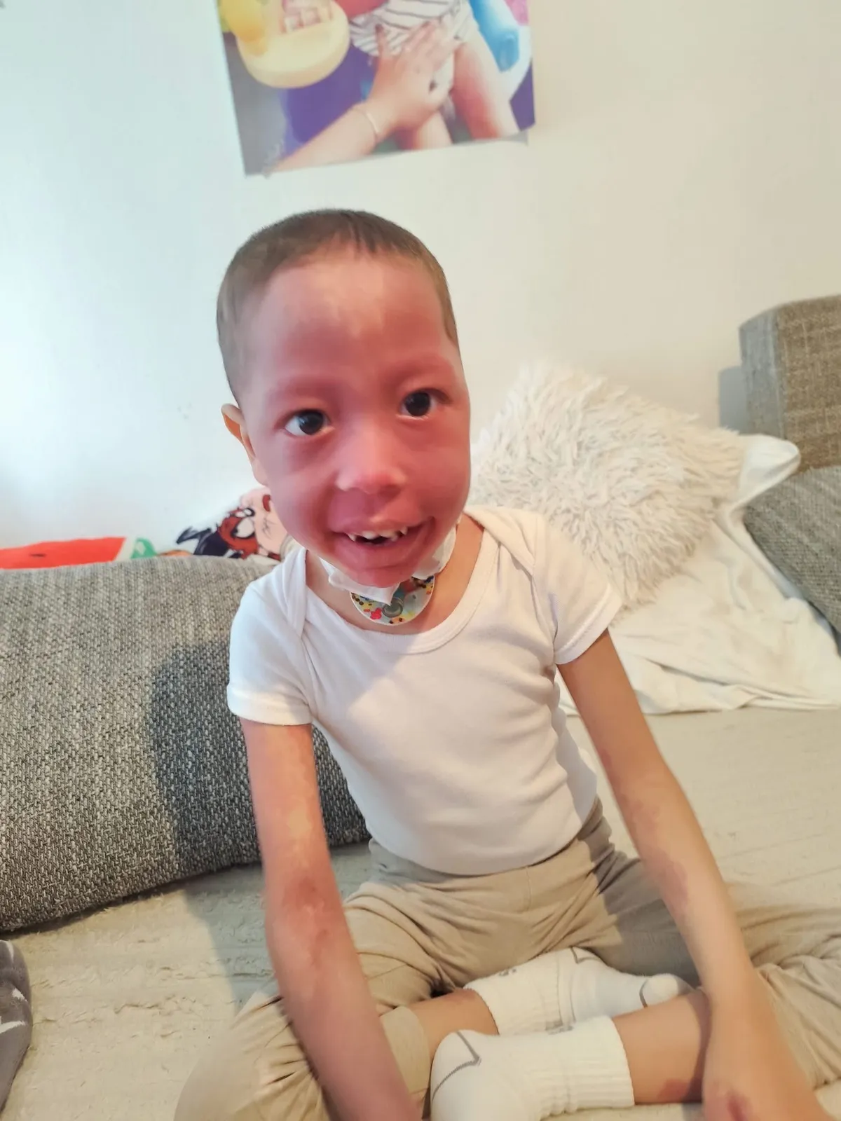 epilepszia