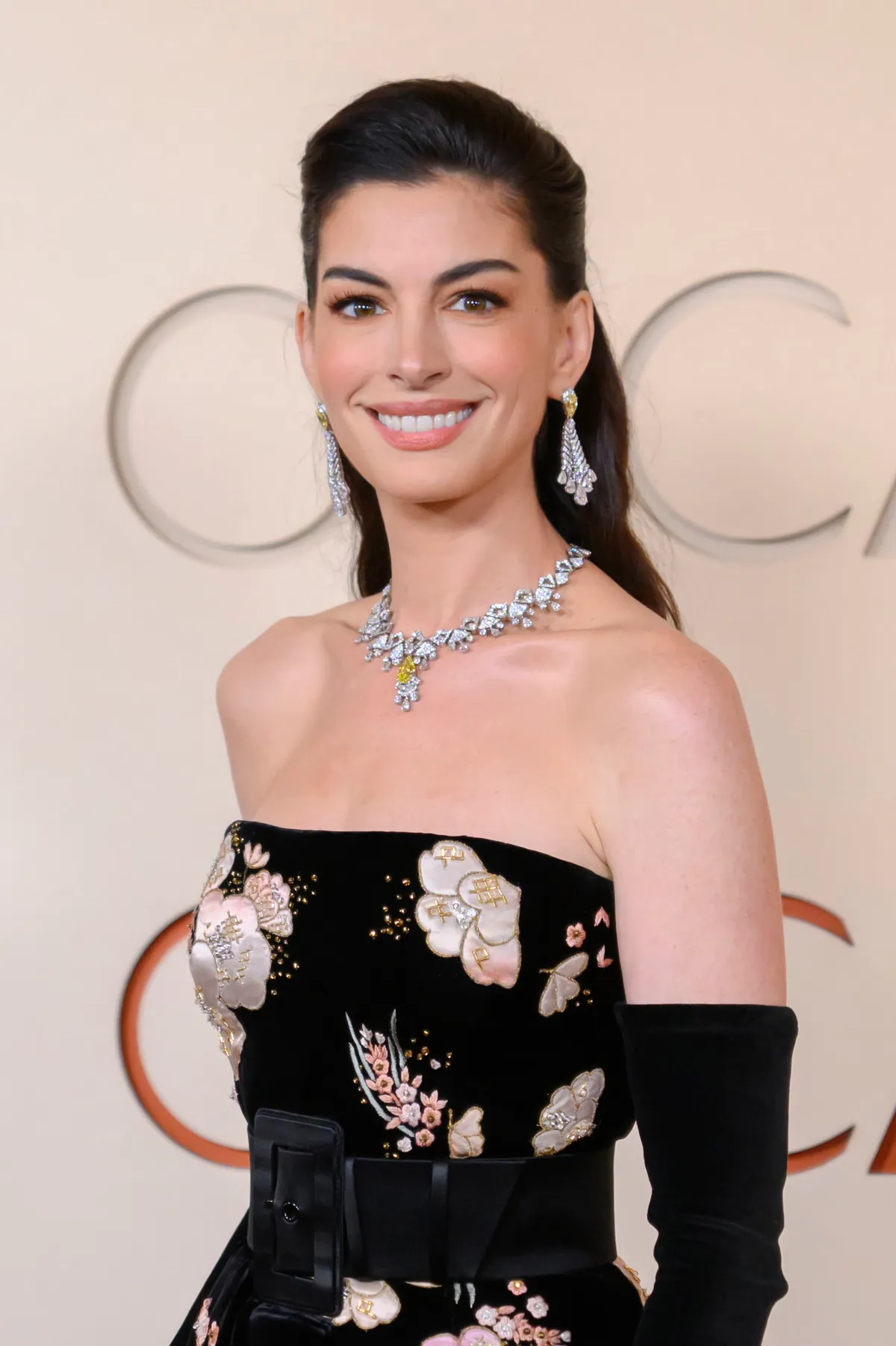 Anne Hathaway Oscar-gála 2026-os megjelenése után elindultak a találgatások a színésznő arcplasztikájával kapcsolatban