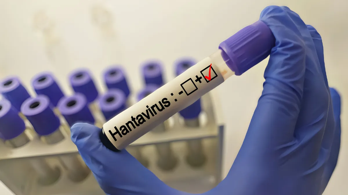 hantavírus