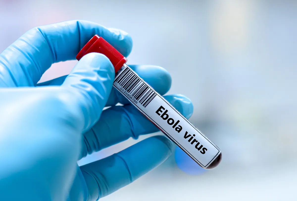Ebola-vírussal fertőzött vérminta