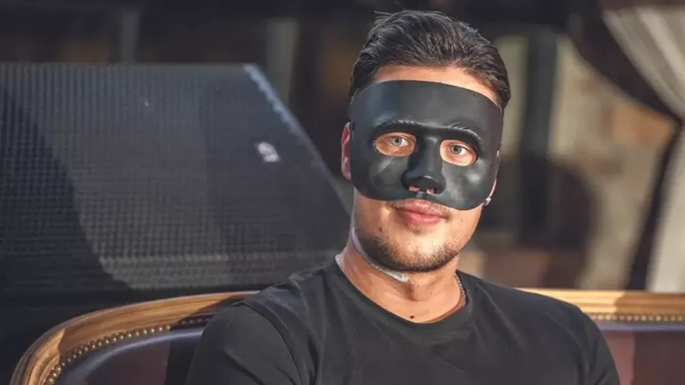 Megszólalt a szakértő T. Danny orrműtétéről: Teljesen új anatómiai struktúrát kap az énekes