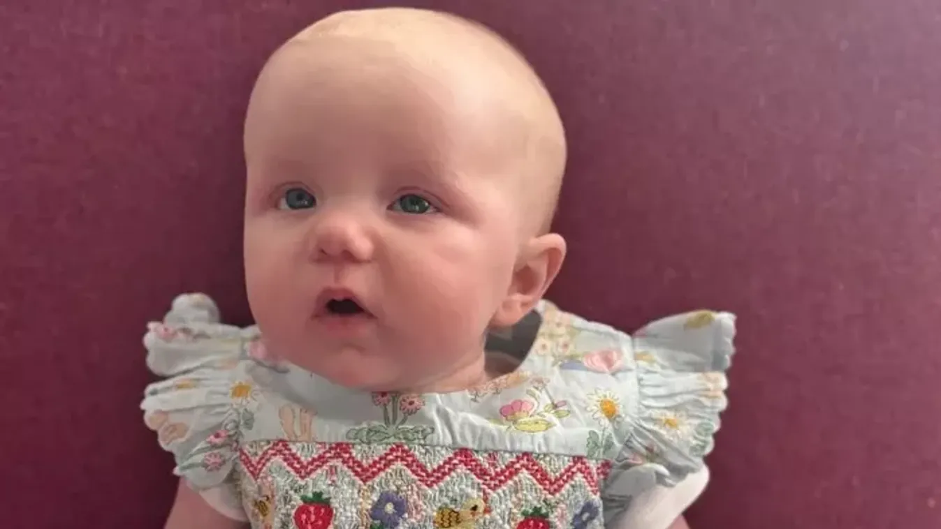 "A kisbabám tüneteit a tejallergiának tulajdonították: most lehet, hogy kétéves kort sem éri meg!"