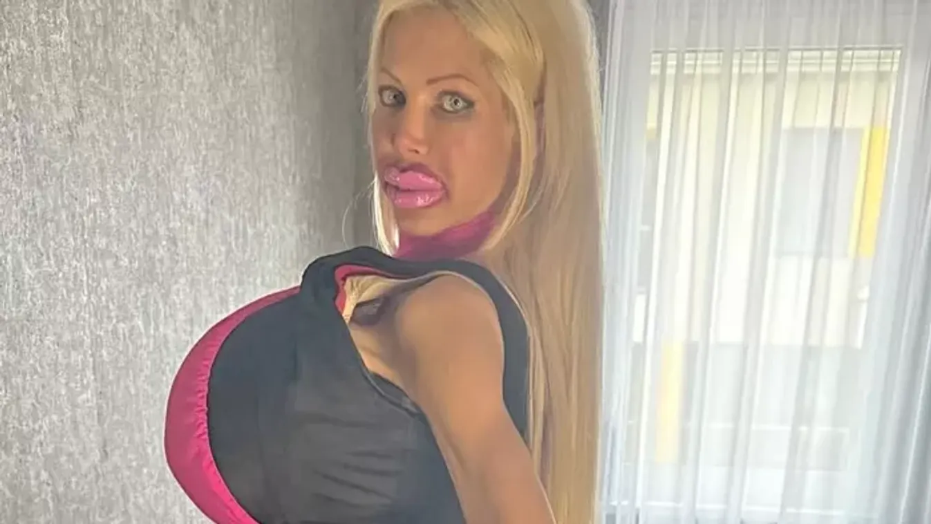 Ismét megműttette melleit Baj Angelika? Brutális fotó!