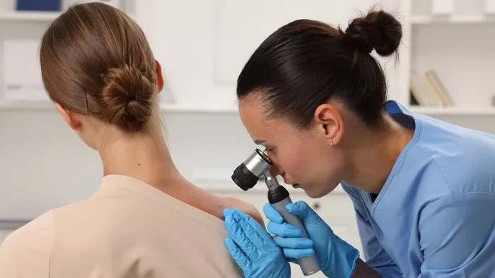 Tényleg csak apró bőrhiba? Így néz ki a véranyajegy