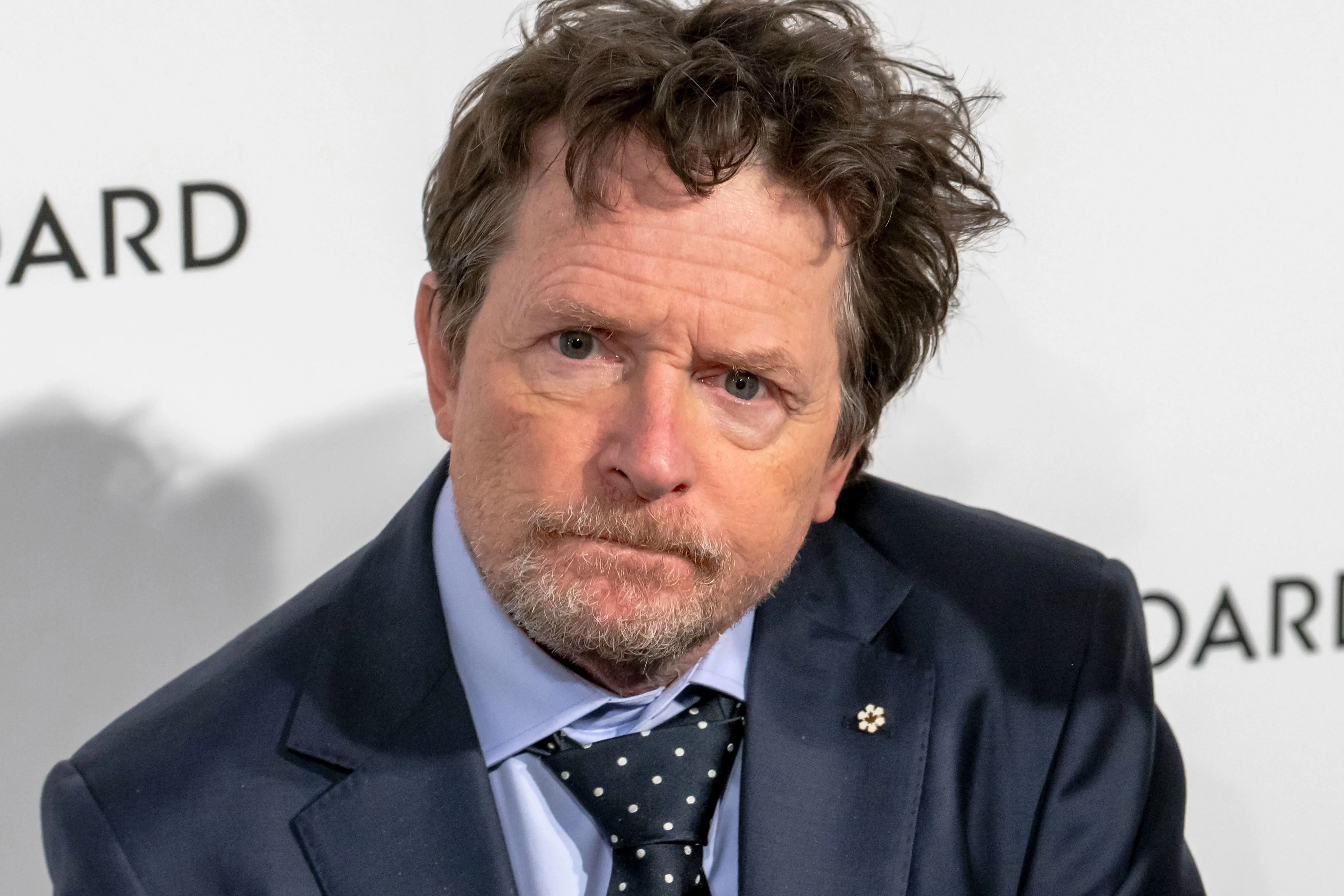 Michael J. Fox őszinte vallomást tett Parkinson-kórjáról