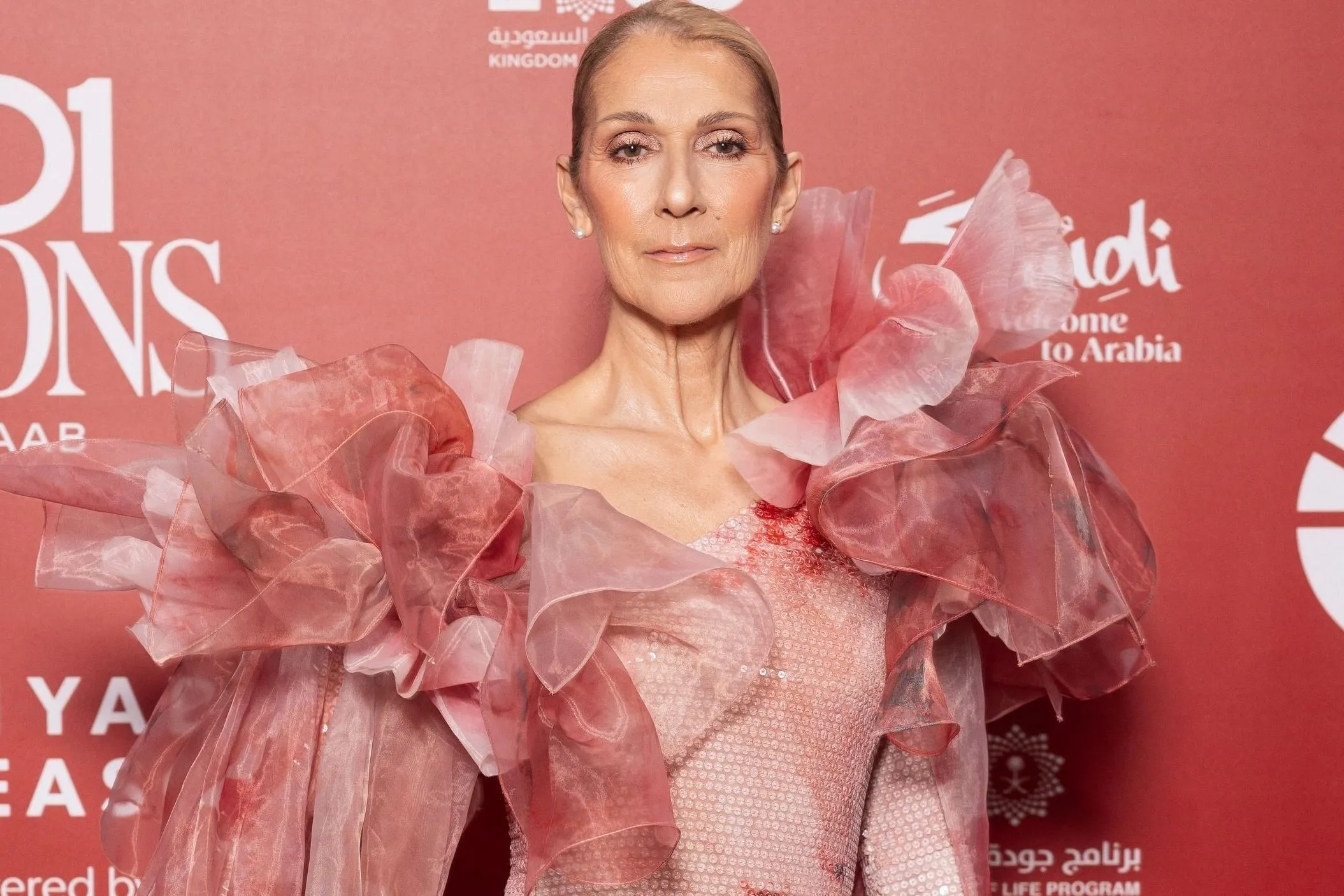 Celine Dion stiff-person szindrómájáról vallott: 17 évig nem tudta, mi a baja