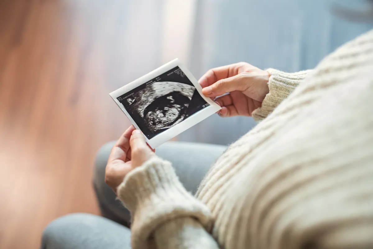Ultrahangos magzatfotót kezében tartó nő fehér pulóverben
