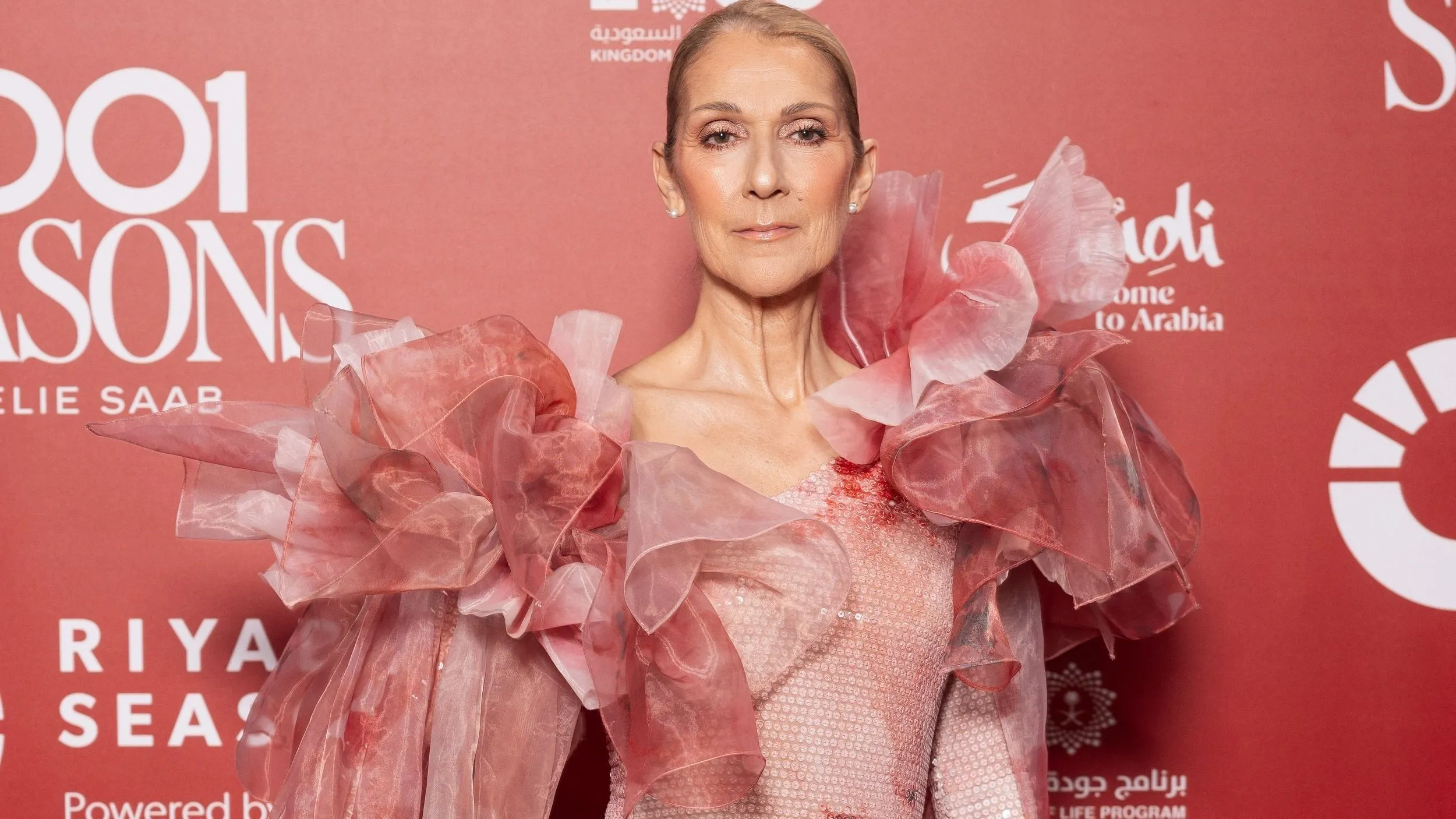 Celine Dion 17 évig nem tudta, mi a baja